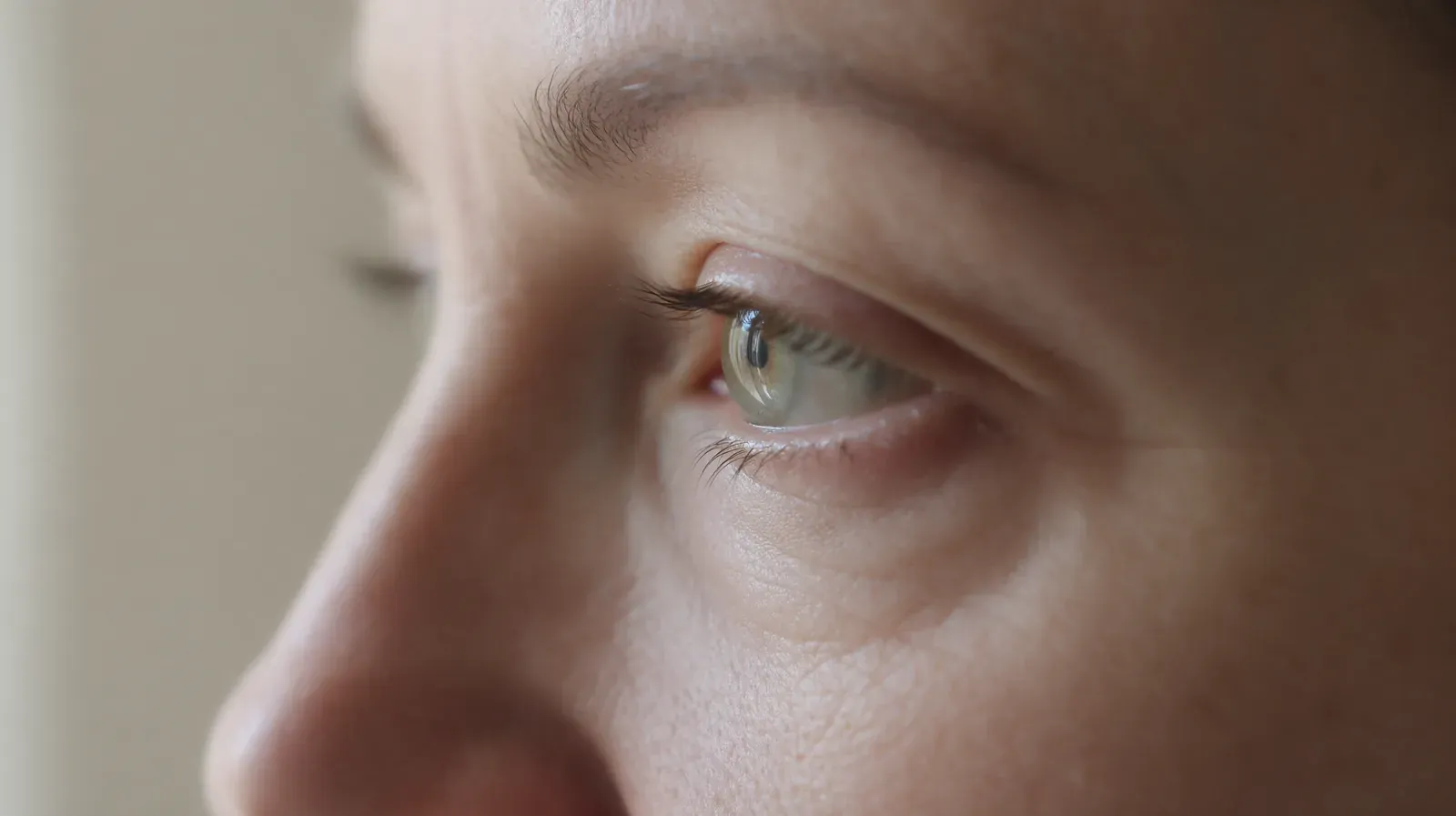 Close-up of an adult woman’s eye and lower eyelid, with a slight bag under the eye in natural window light