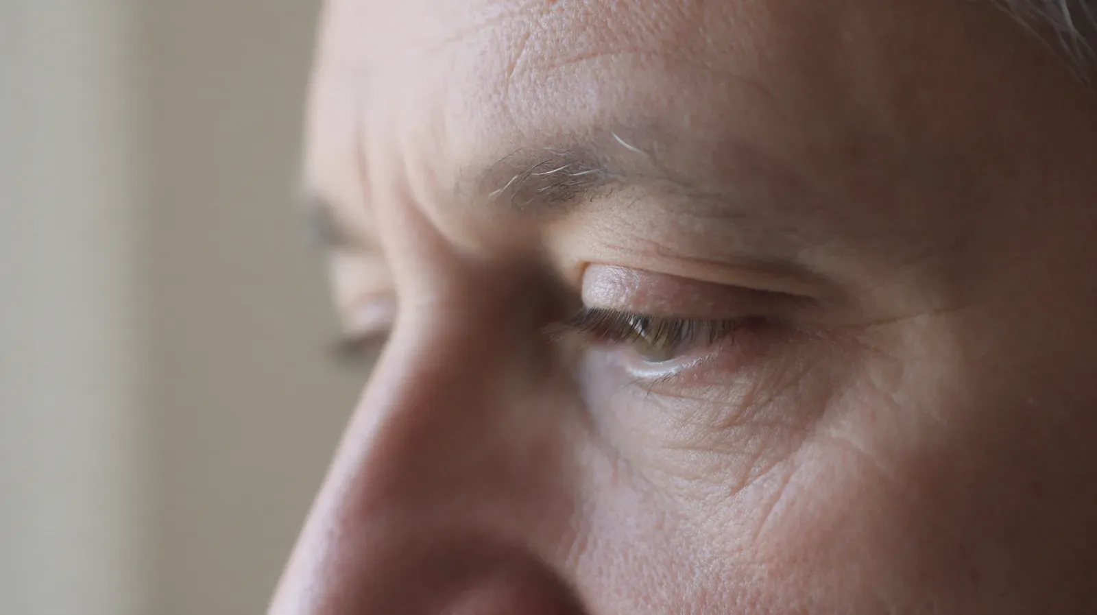Close-up of a mature man’s upper eyelid and eyebrow, with a fold of skin resting near the eyelashes